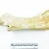 Pelvis 1986.008.0818